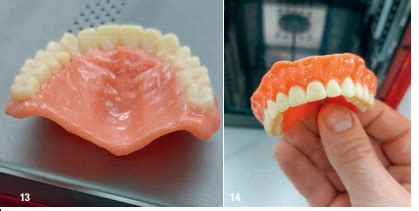 3d printed dentures reviews|3D Printed Complete Removable Dental Prostheses: .